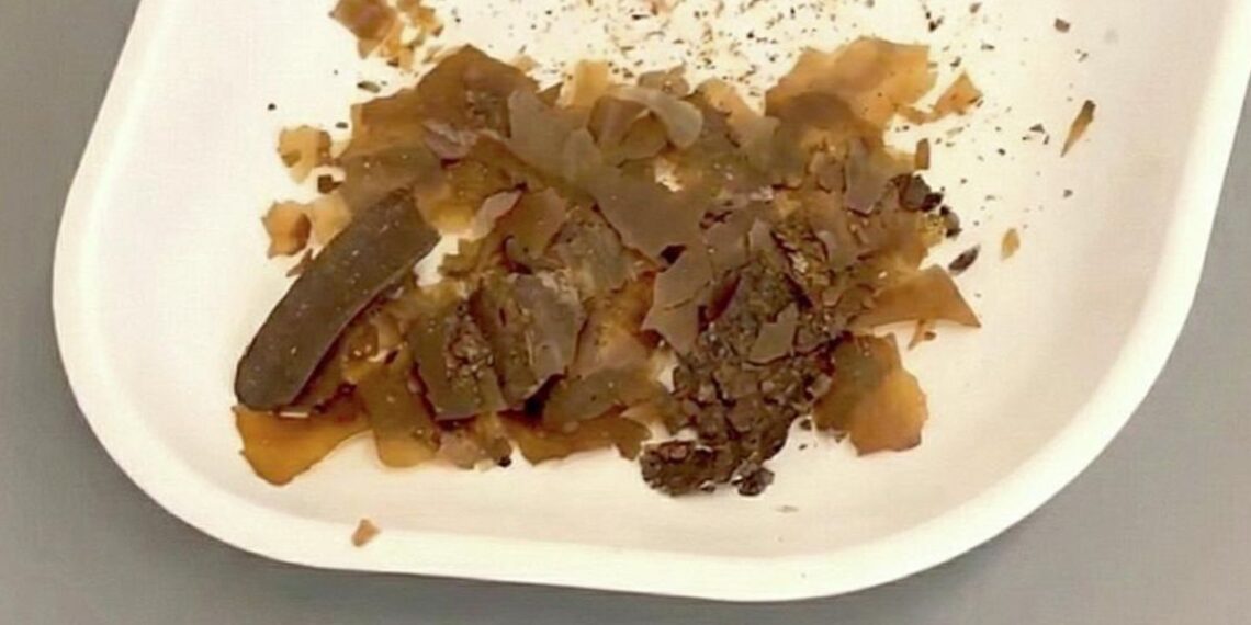 Senovės romėnai gydėsi išmatomis? Naujas atradimas pribloškė mokslininkus