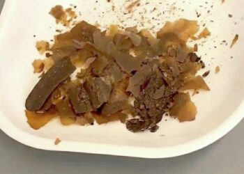 Senovės romėnai gydėsi išmatomis? Naujas atradimas pribloškė mokslininkus