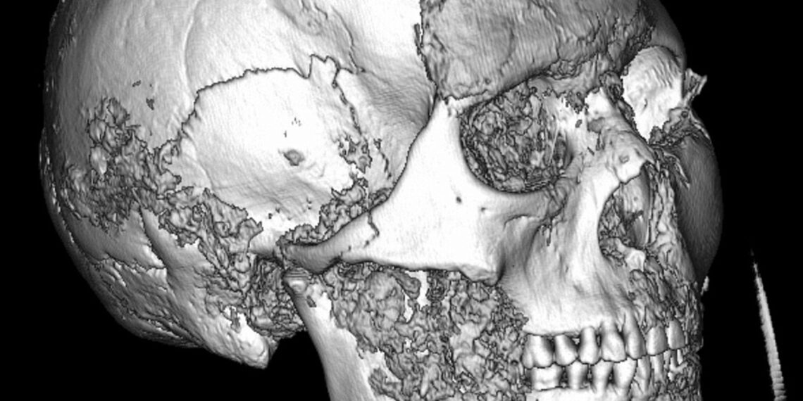Sensacingas atradimas Altajuje: paaiškėjo, kad sudėtingos operacijos Azijoje buvo atliekamos dar prieš tūkstantmečius