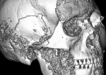 Sensacingas atradimas Altajuje: paaiškėjo, kad sudėtingos operacijos Azijoje buvo atliekamos dar prieš tūkstantmečius