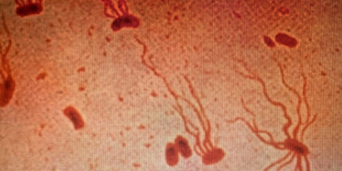 Šiltinė grįžta su nauja grėsme: bakterija tampa atspari beveik visiems vaistams