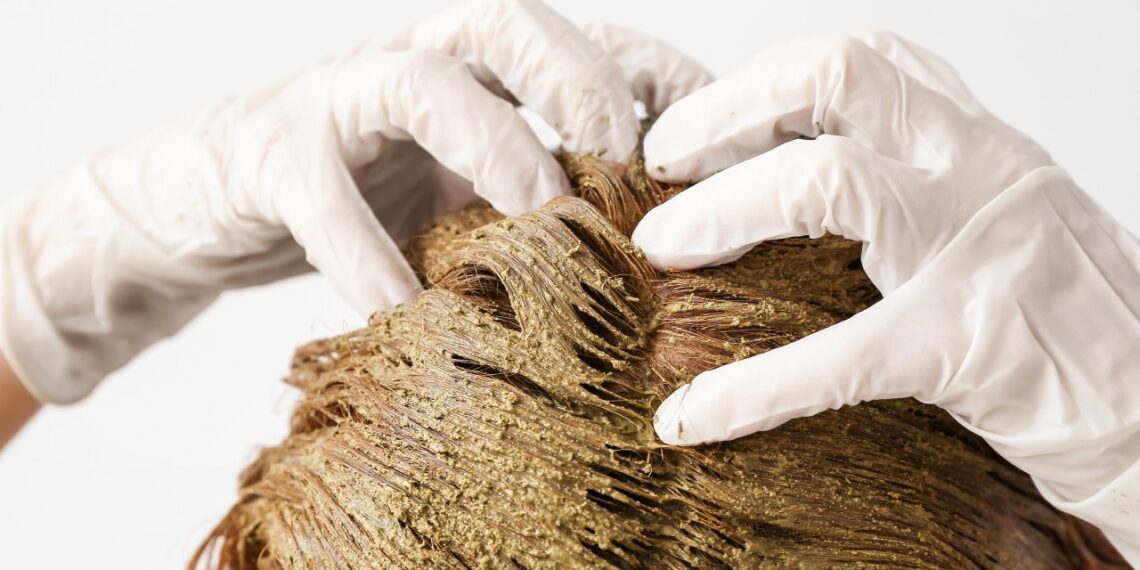 Vienas paprastas namų metodas, kuris per kelias savaites sustiprino plaukus