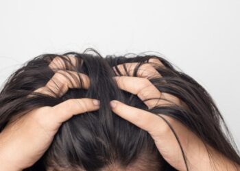 Niežtinti galvos oda gali išduoti rimtas problemas: 7 priežastys, apie kurias įspėja gydytojai