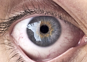 Šokiruojantis atradimas: akies dugne aptiktos bakterijos gali spartinti Alzheimerio ligą