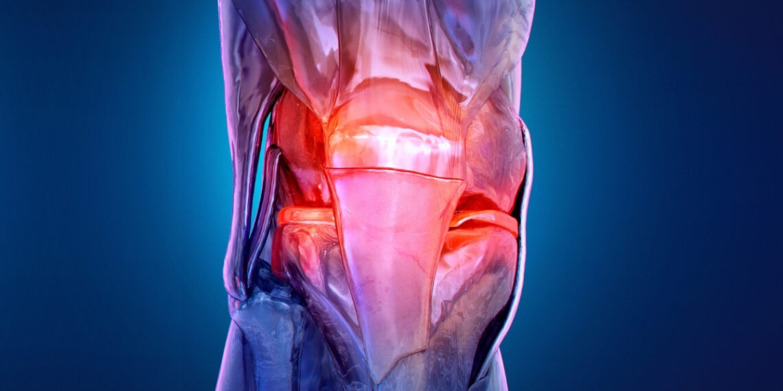 Vis daugiau jaunų žmonių susiduria su artroze: ar tai skausmas visam gyvenimui?