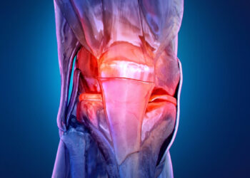 Vis daugiau jaunų žmonių susiduria su artroze: ar tai skausmas visam gyvenimui?