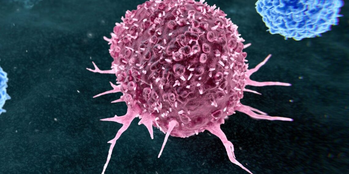 Šokiruojantis tyrimas: netikėta tiesa – du kasdieniai įpročiai lemia daugumą vėžio atvejų