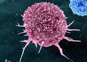 Šokiruojantis tyrimas: netikėta tiesa – du kasdieniai įpročiai lemia daugumą vėžio atvejų