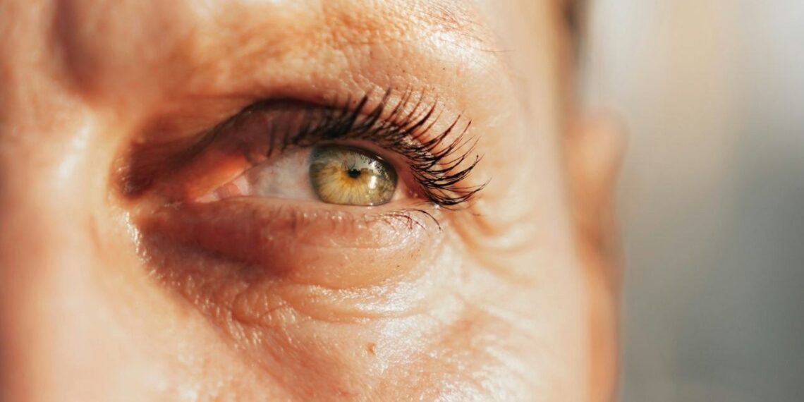 Moterys šluoja šį nebrangų preparatą – kalbama apie poveikį raukšlelėms aplink akis