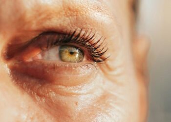 Moterys šluoja šį nebrangų preparatą – kalbama apie poveikį raukšlelėms aplink akis