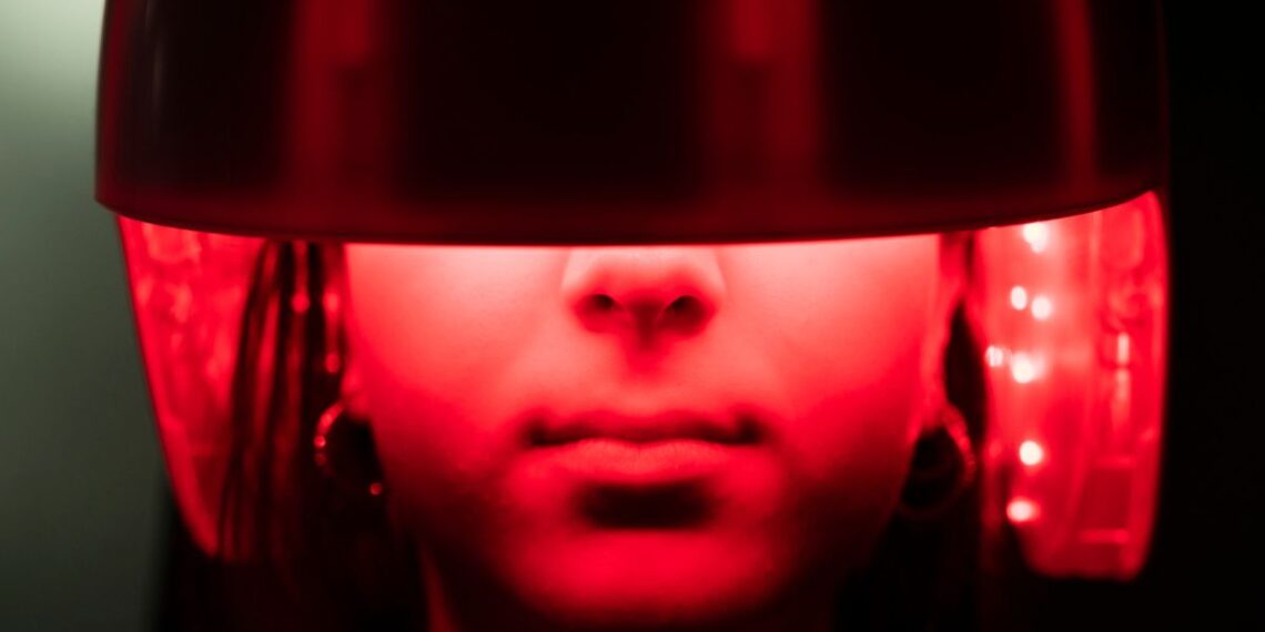 Mokslininkai praneša: šviesos terapija 92 % sumažino plikimo rodiklį