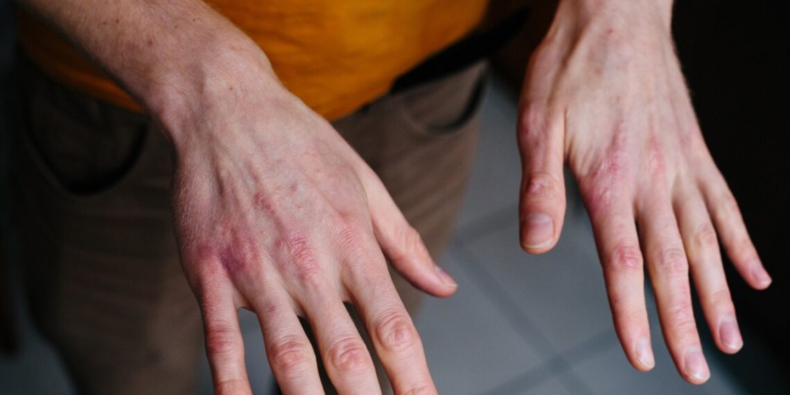 Rankos kaip švitrinis popierius? Šie nebrangūs kremai gali greitai pagerinti odos būklę