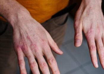 Rankos kaip švitrinis popierius? Šie nebrangūs kremai gali greitai pagerinti odos būklę