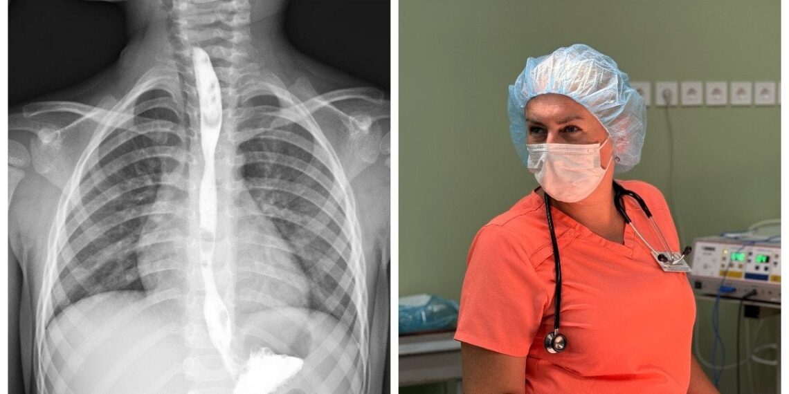 Dviejų metų drama Lvove: trejų metų berniukas išgėrė riebalų valiklį, gydytojai išgelbėjo gyvybę