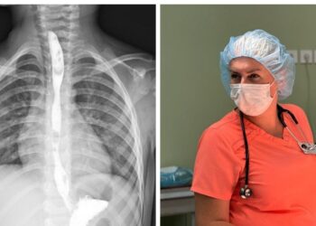 Dviejų metų drama Lvove: trejų metų berniukas išgėrė riebalų valiklį, gydytojai išgelbėjo gyvybę