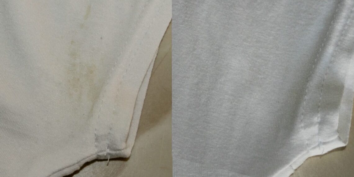 Geltonos dėmės pažastyse išnyksta per 40 minučių: paprasta naminė pasta daro stebuklus