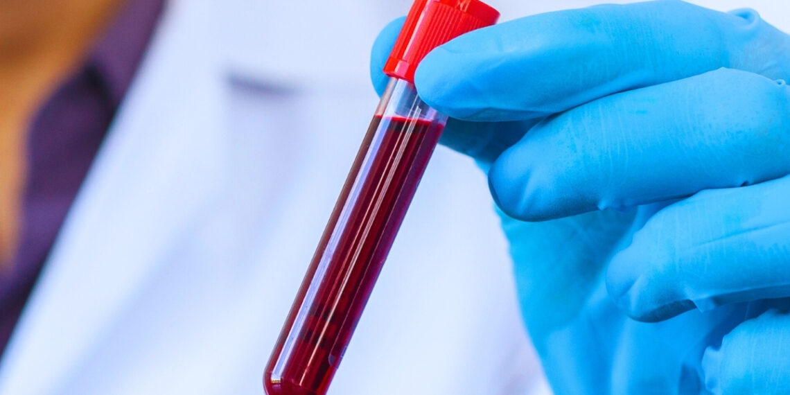 Mokslininkai ištyrė šimtamečių kraują: 37 baltymai gali atskleisti lėtesnio senėjimo paslaptį