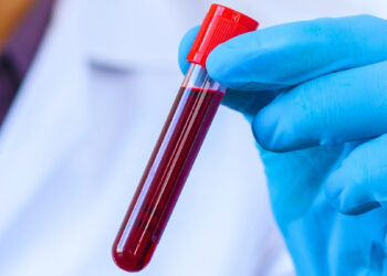 Mokslininkai ištyrė šimtamečių kraują: 37 baltymai gali atskleisti lėtesnio senėjimo paslaptį