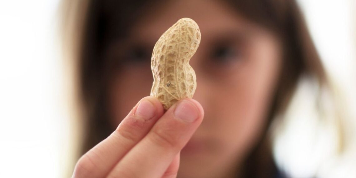 Mokslininkai aptiko bakterijas, kurios gali slopinti žemės riešutų alergiją