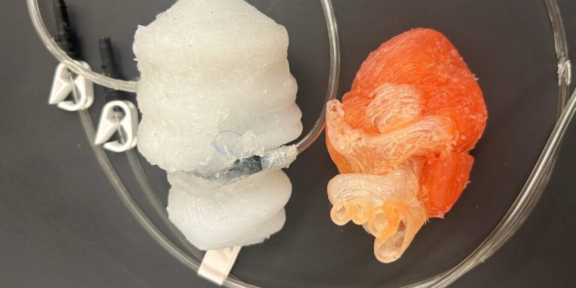 Stulbinantis medicinos pasiekimas: laboratorijoje atspausdinta plakanti širdis