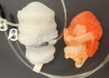 Stulbinantis medicinos pasiekimas: laboratorijoje atspausdinta plakanti širdis