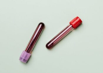 Mokslininkai įspėja: didėjantis CO₂ kiekis gali paveikti žmogaus kraują ir kaulus