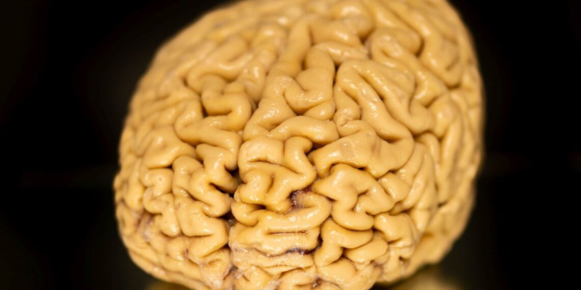 Mokslininkai nustebo: itin garbaus amžiaus žmonių aštraus proto paslaptis – atsinaujinančios smegenų ląstelės