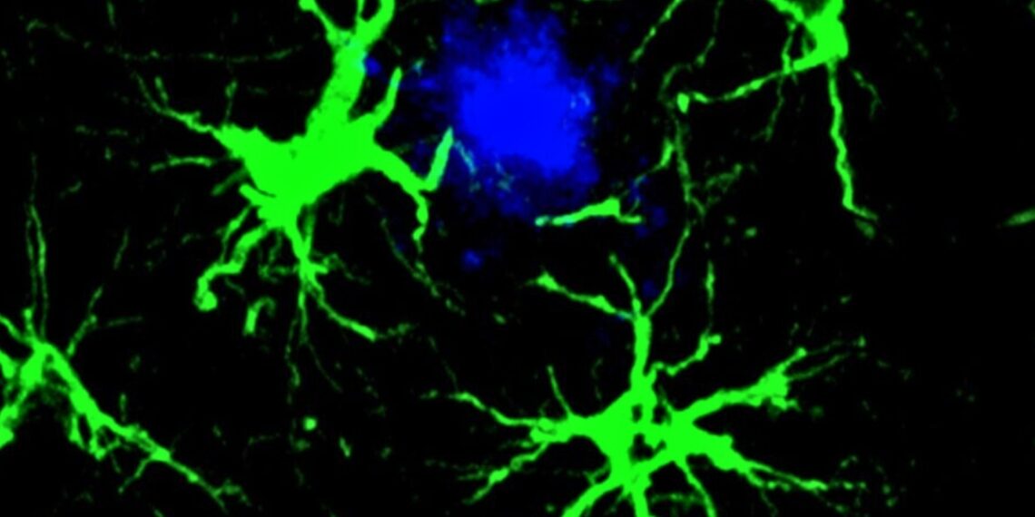 Nauja viltis kovai su Alzheimerio liga: eksperimentas pelėms davė stulbinančių rezultatų