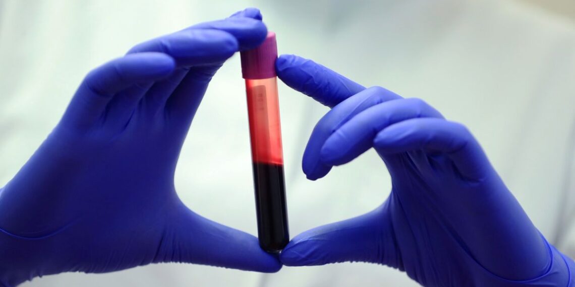 Mokslininkai perspėja: didėjantis CO₂ kiekis gali paveikti žmogaus kraujo sudėtį