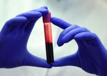 Mokslininkai perspėja: didėjantis CO₂ kiekis gali paveikti žmogaus kraujo sudėtį