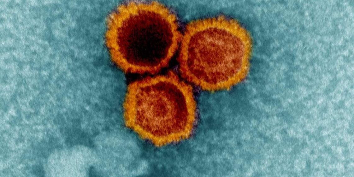 Mokslininkai aptiko svarbių įrodymų: įprastas virusas gali būti susijęs su išsėtine skleroze