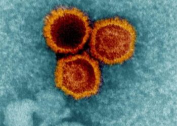 Mokslininkai aptiko svarbių įrodymų: įprastas virusas gali būti susijęs su išsėtine skleroze