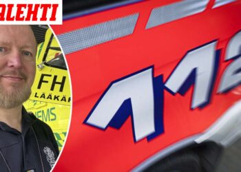 Staigi organizmo reakcija gali užklupti netikėtai: gydytojas paaiškino, kodėl taip nutinka